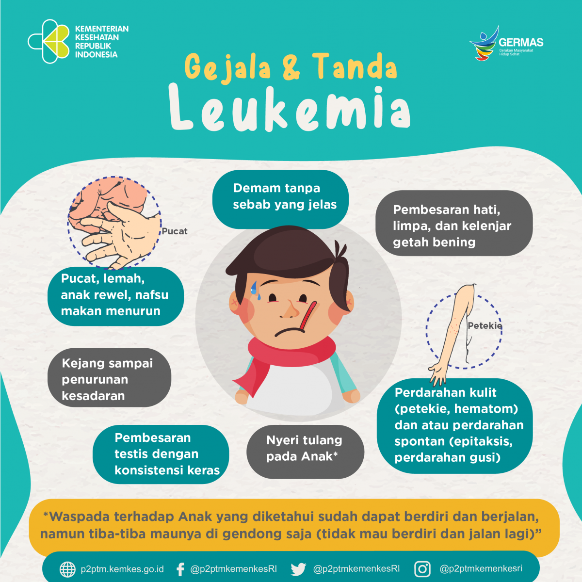 Penyakit leukemia antara lain gejala Alami Leukositosis,
