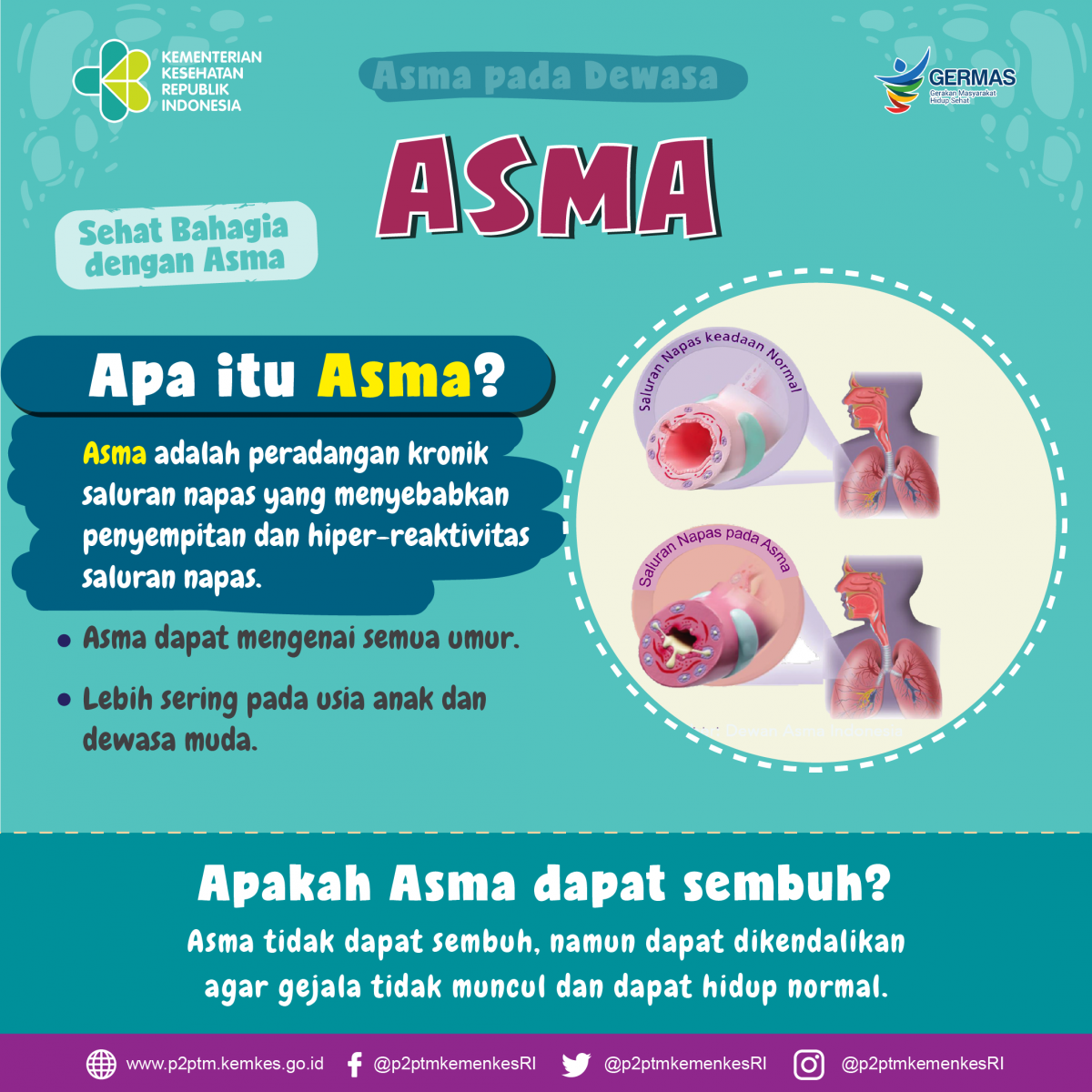 Apakah asma bisa sembuh