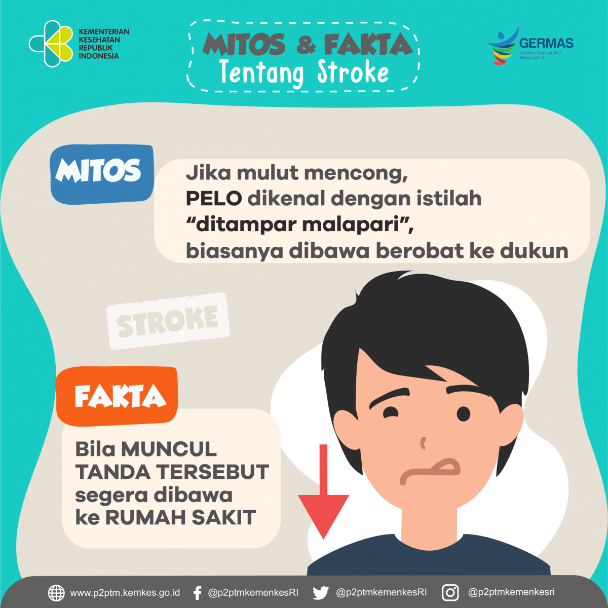 Segera Ke Rumah Sakit Jika Mengalami Gejala Atau Tanda Stroke Seperti