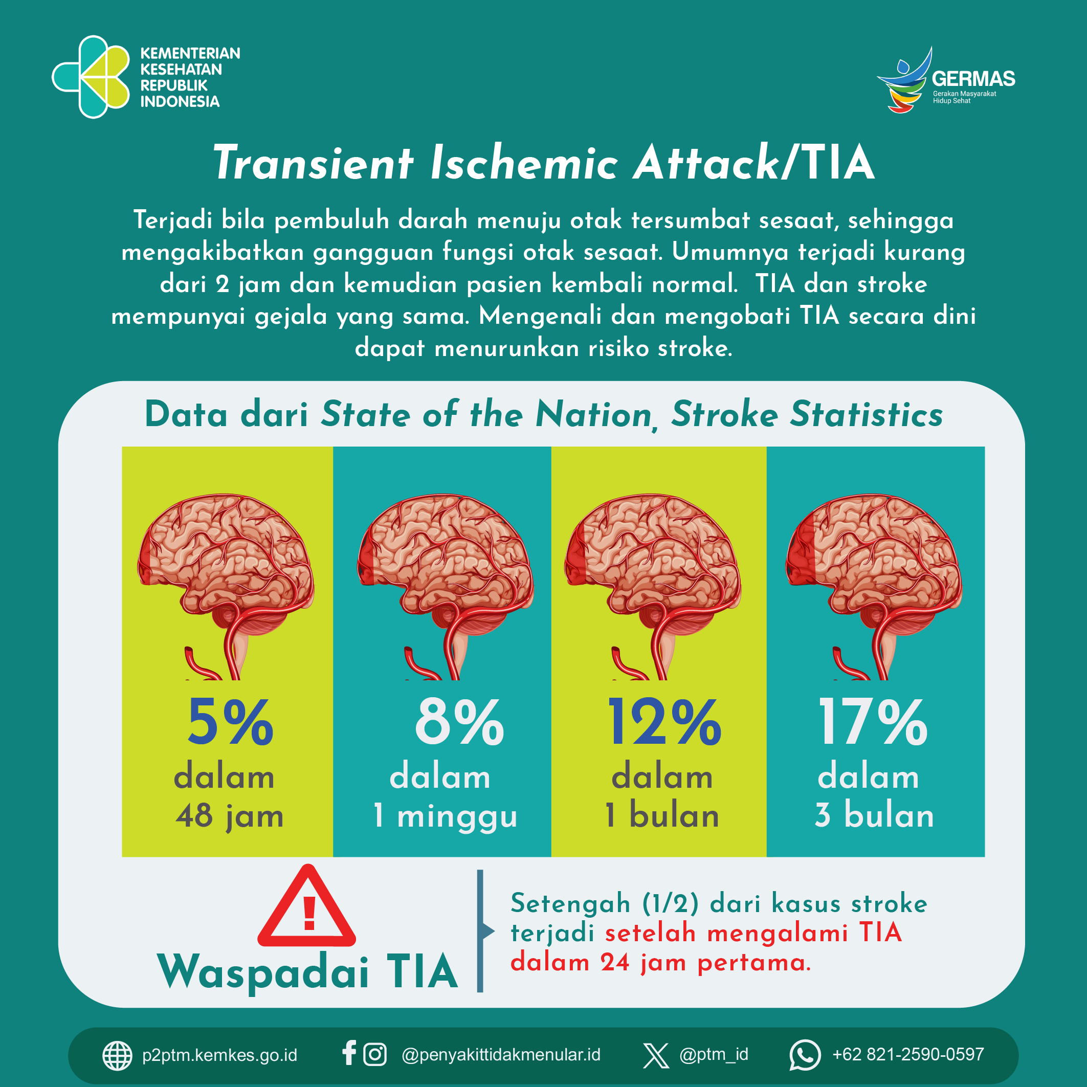 Transient Ischemic Attack / TIA 