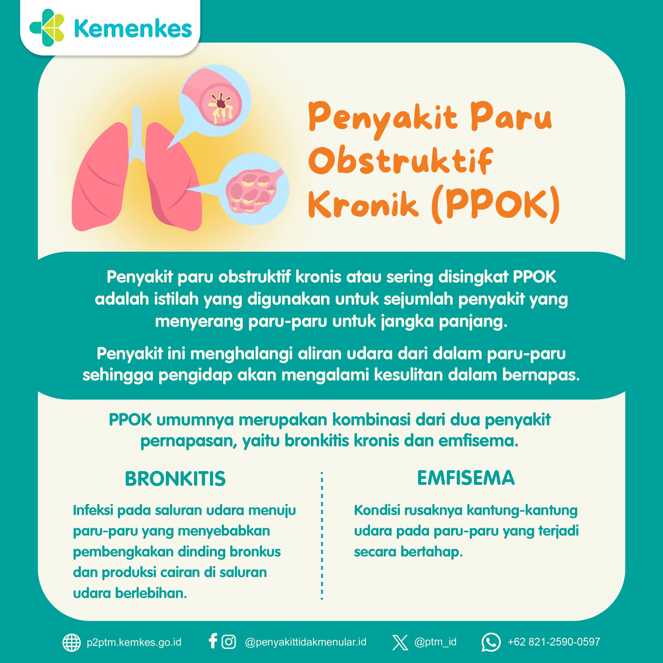 Penyakit Paru Obstruktif Kronik (PPOK)