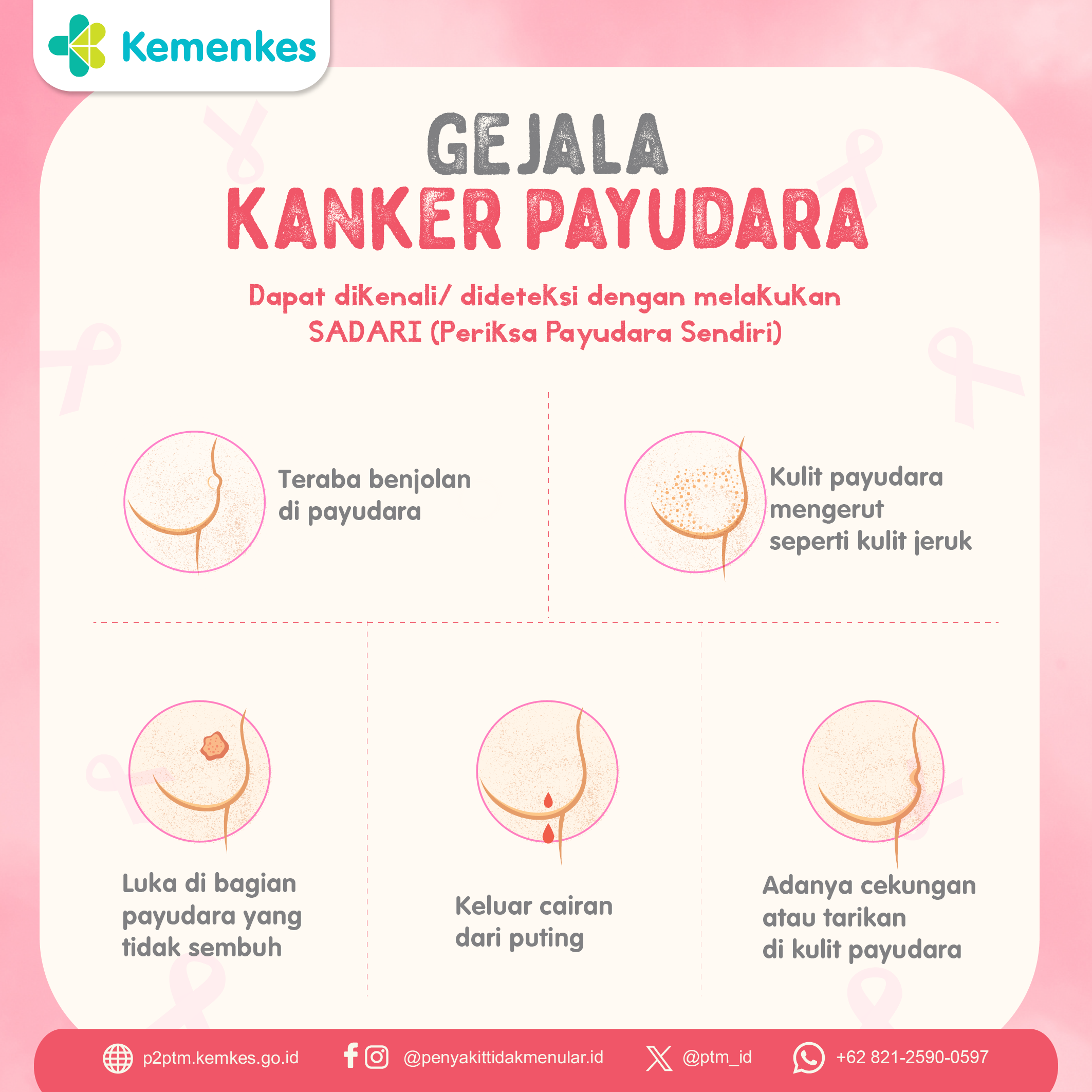 Gejala-gejala Kanker Payudara