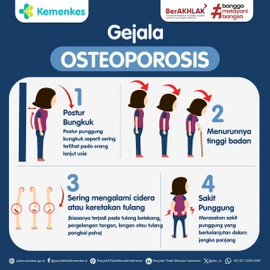 Kenali Gejala Osteoporosis: Jangan Abaikan Sinyal dari Tulangmu!