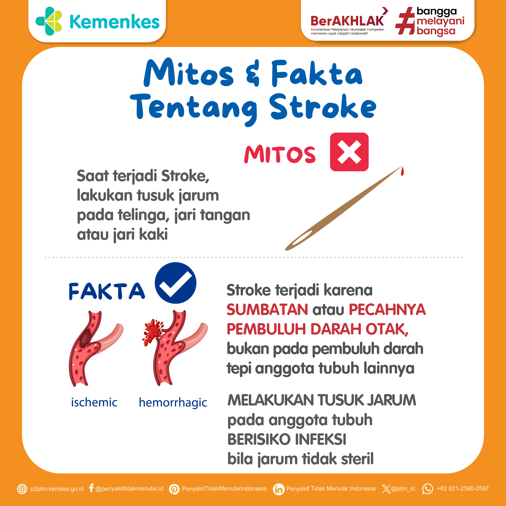 Mitos atau Fakta: Menusuk dengan Jarum untuk Stroke