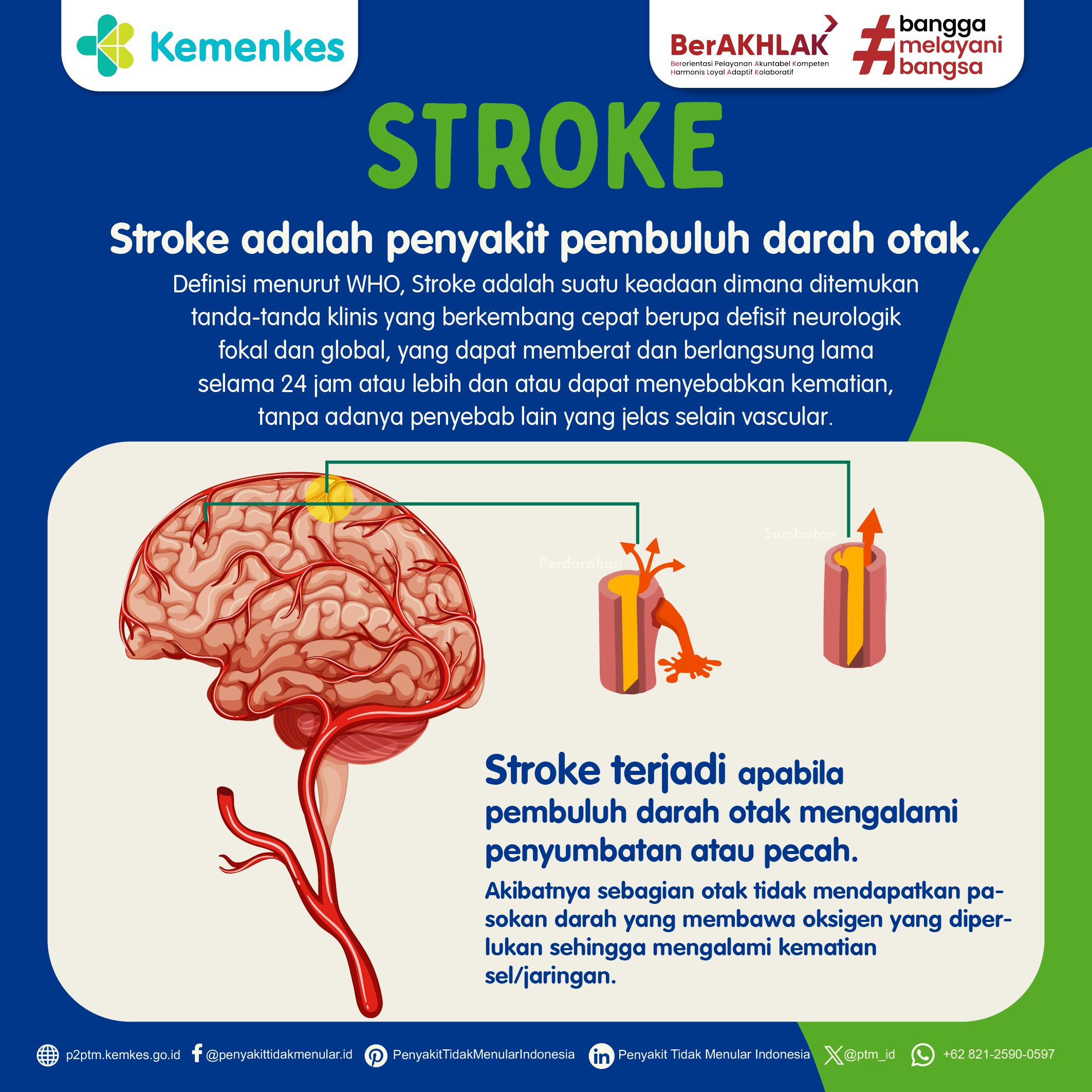 Apa Itu Stroke? Kenali Penyebab, Gejala, dan Cara Mencegahnya