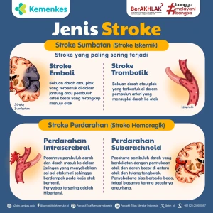 Jenis-Jenis Stroke Iskemik dan Hemoragik