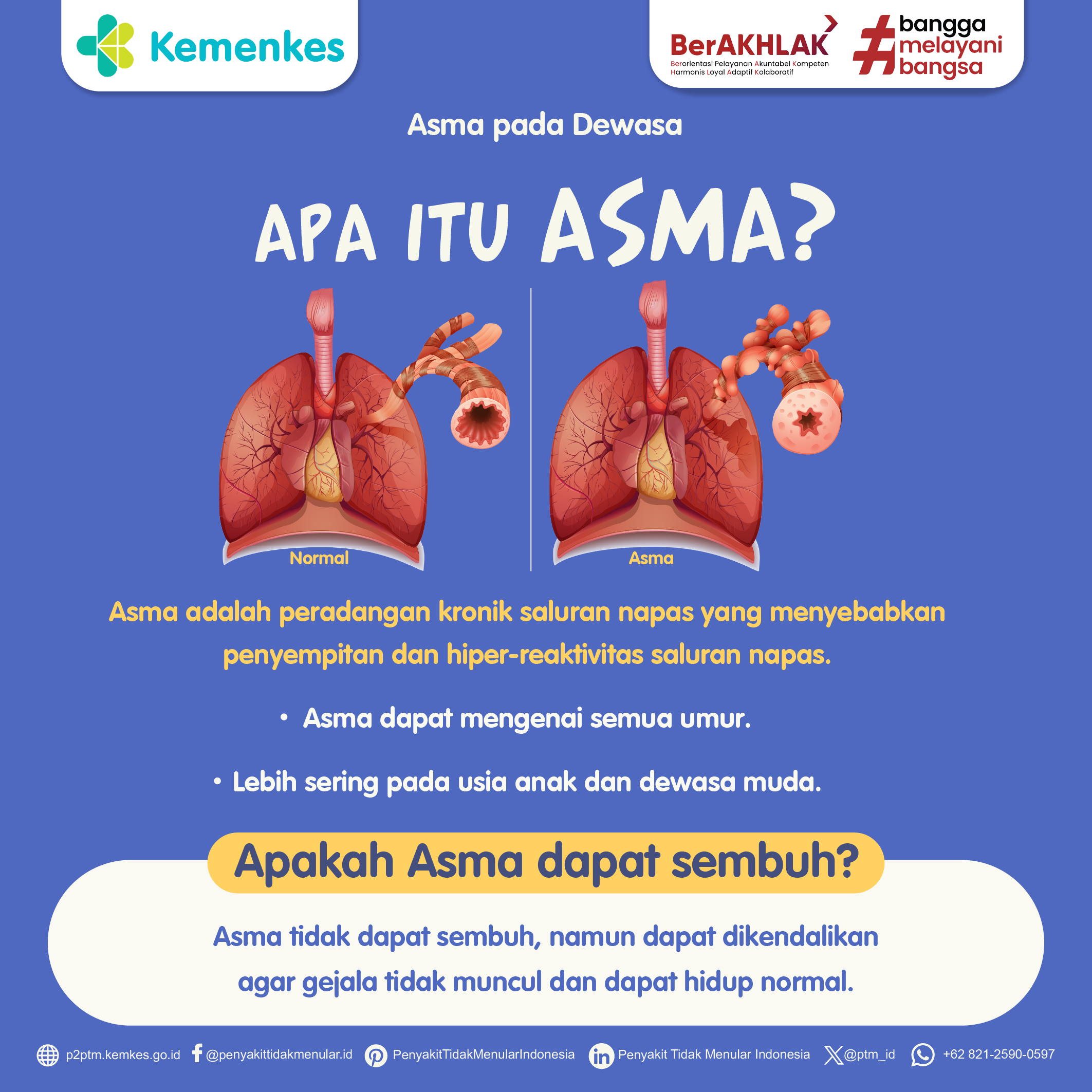 Apa yang Dimaksud Penyakit Asma?