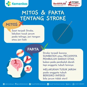 Mitos vs Fakta: Tusuk Jarum Tidak Dapat Menyembuhkan Stroke