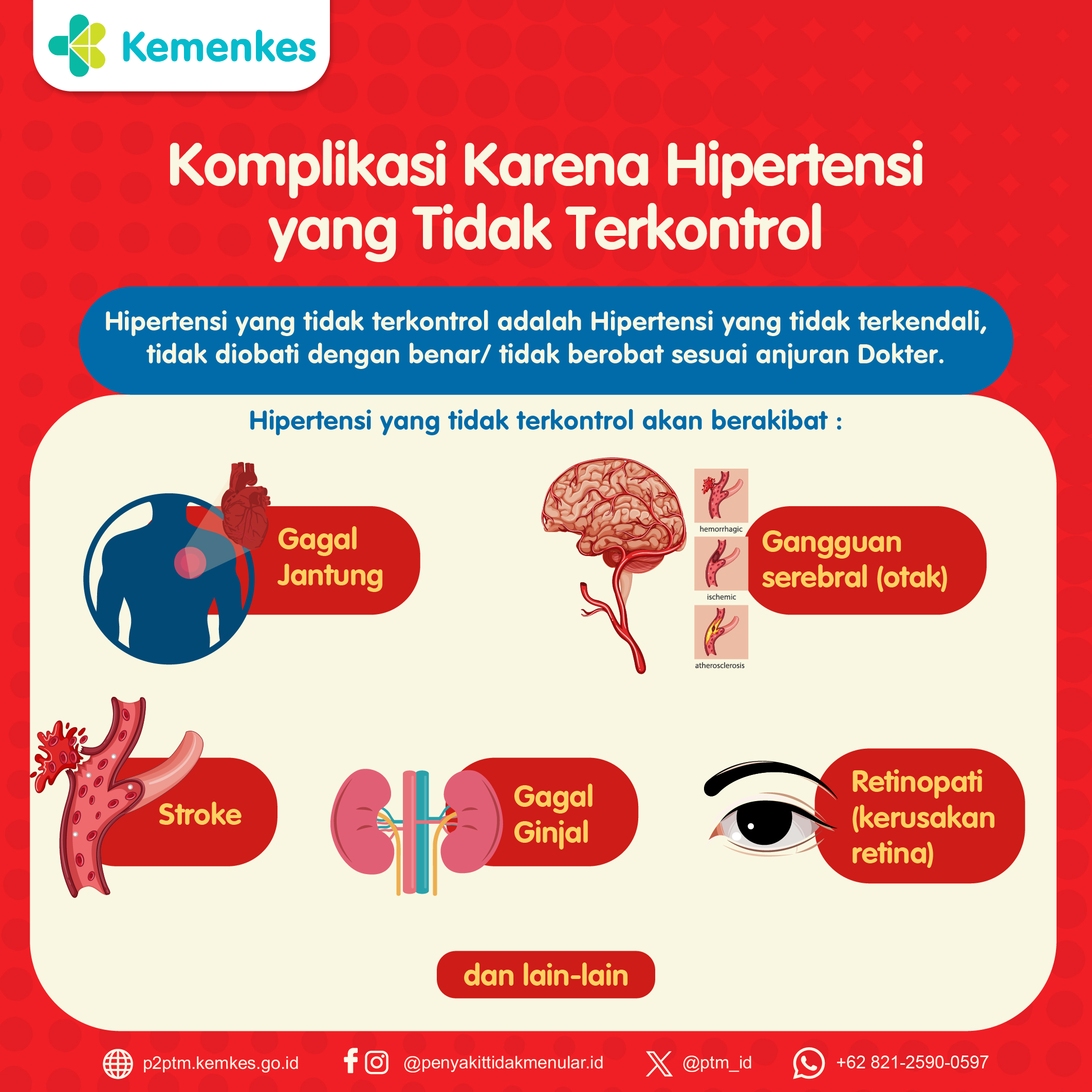 Komplikasi Karena Hipertensi yang Tidak Terkontrol