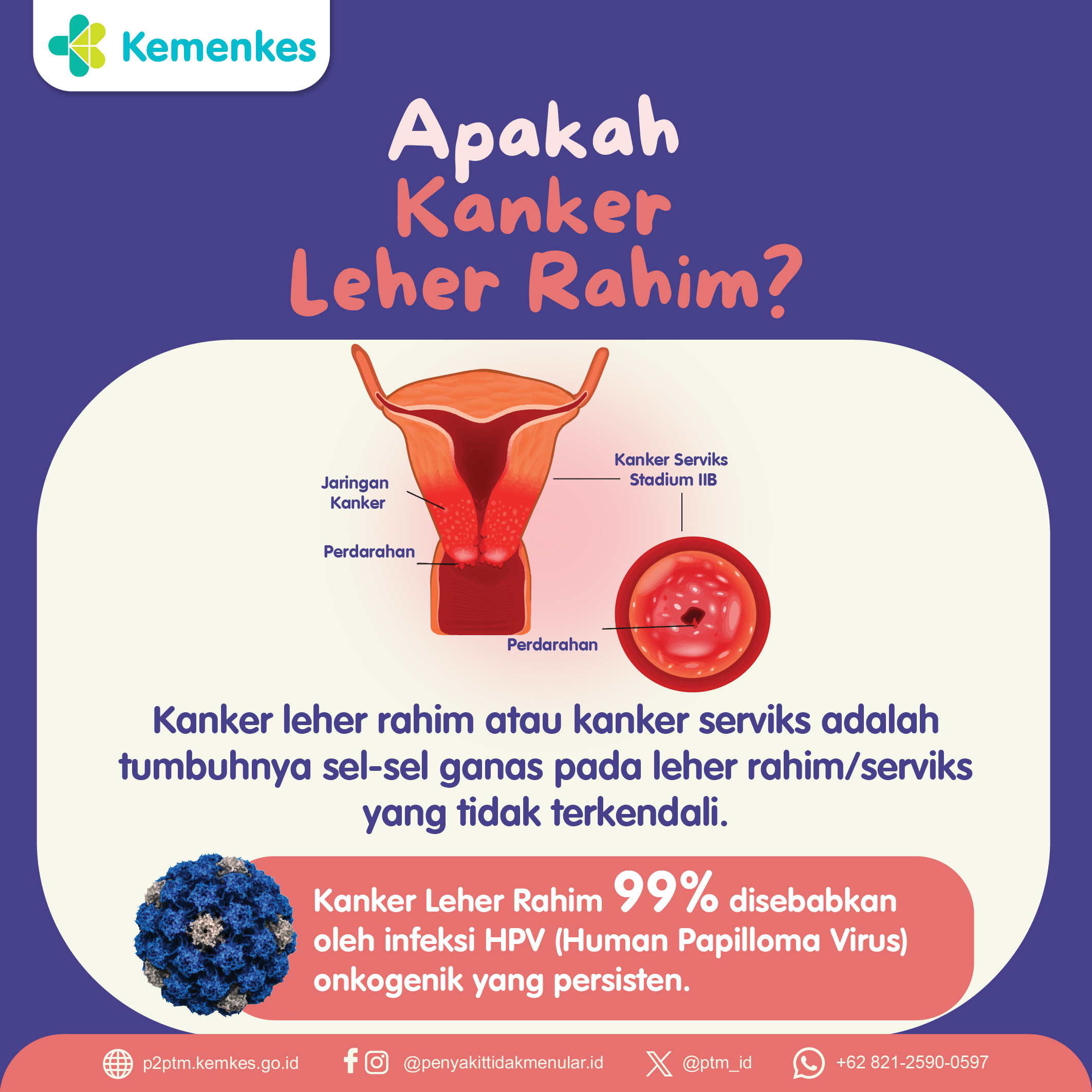 Apakah yang Dimaksud dengan Kanker Leher Rahim?