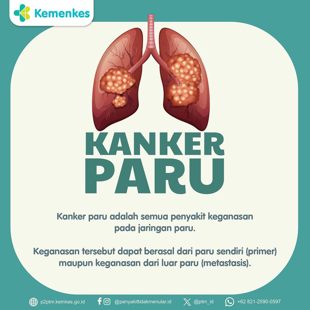 Mengenal Kanker Paru