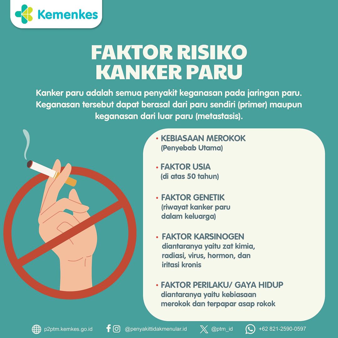 Berikut Faktor Risiko Kanker Paru