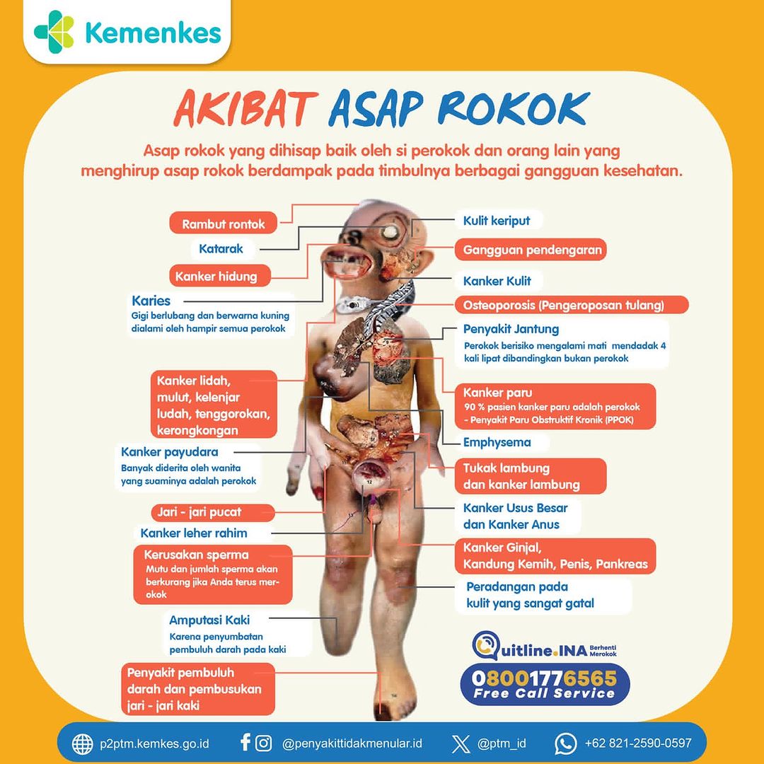 Berikut Akibat yang Muncul dari Asap Rokok