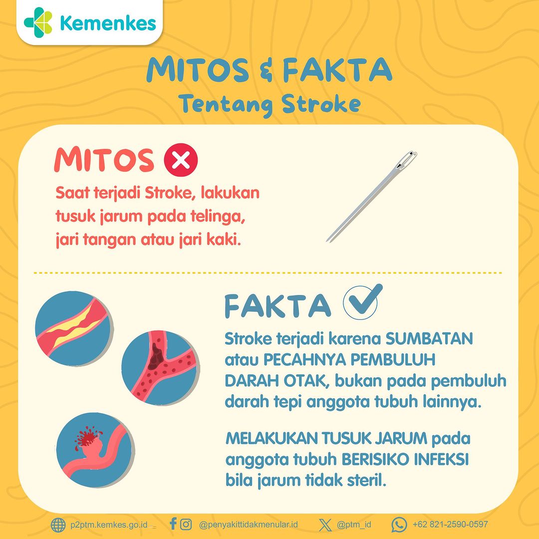 Mitos dan Fakta tentang Penyakit Stroke (5)