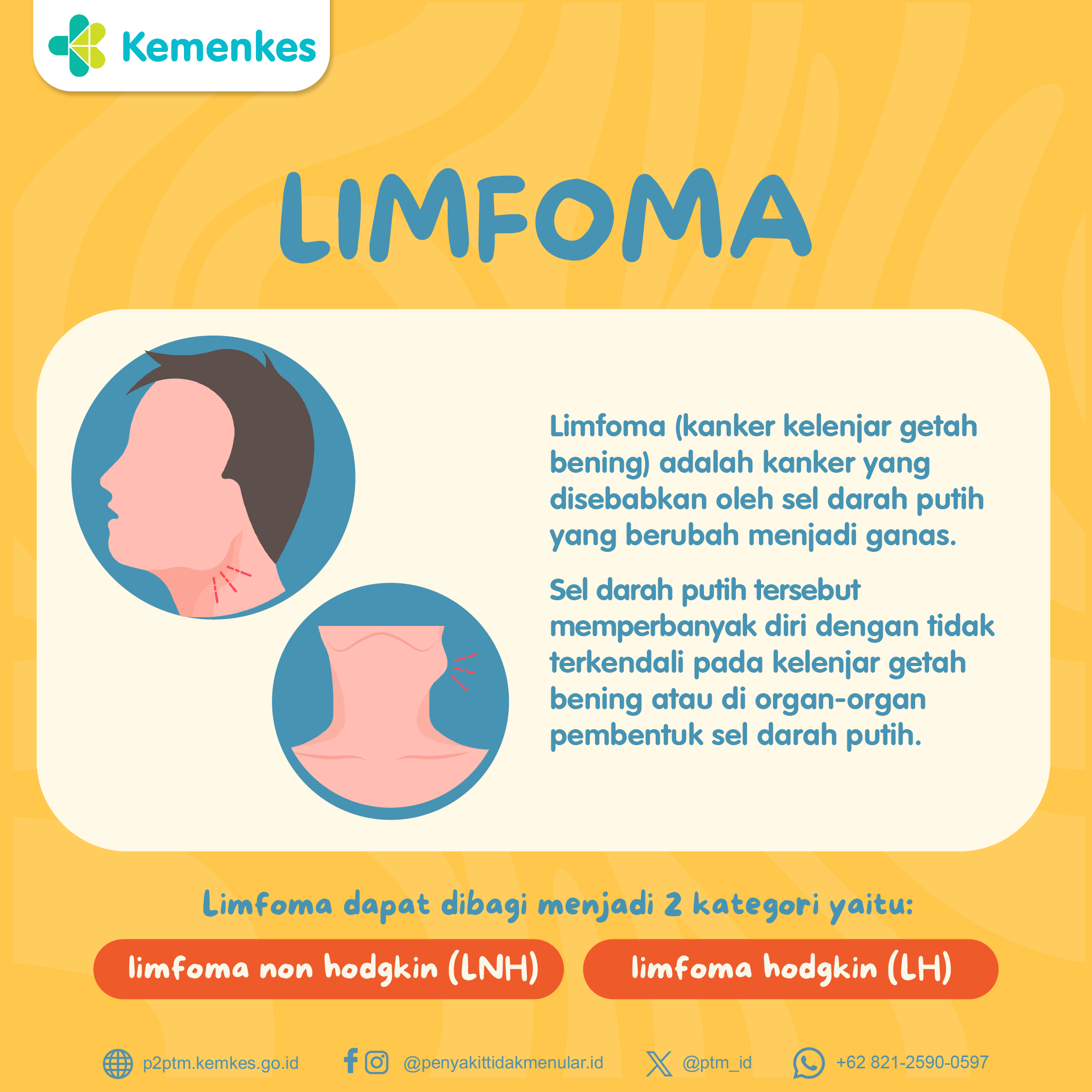 Limfoma