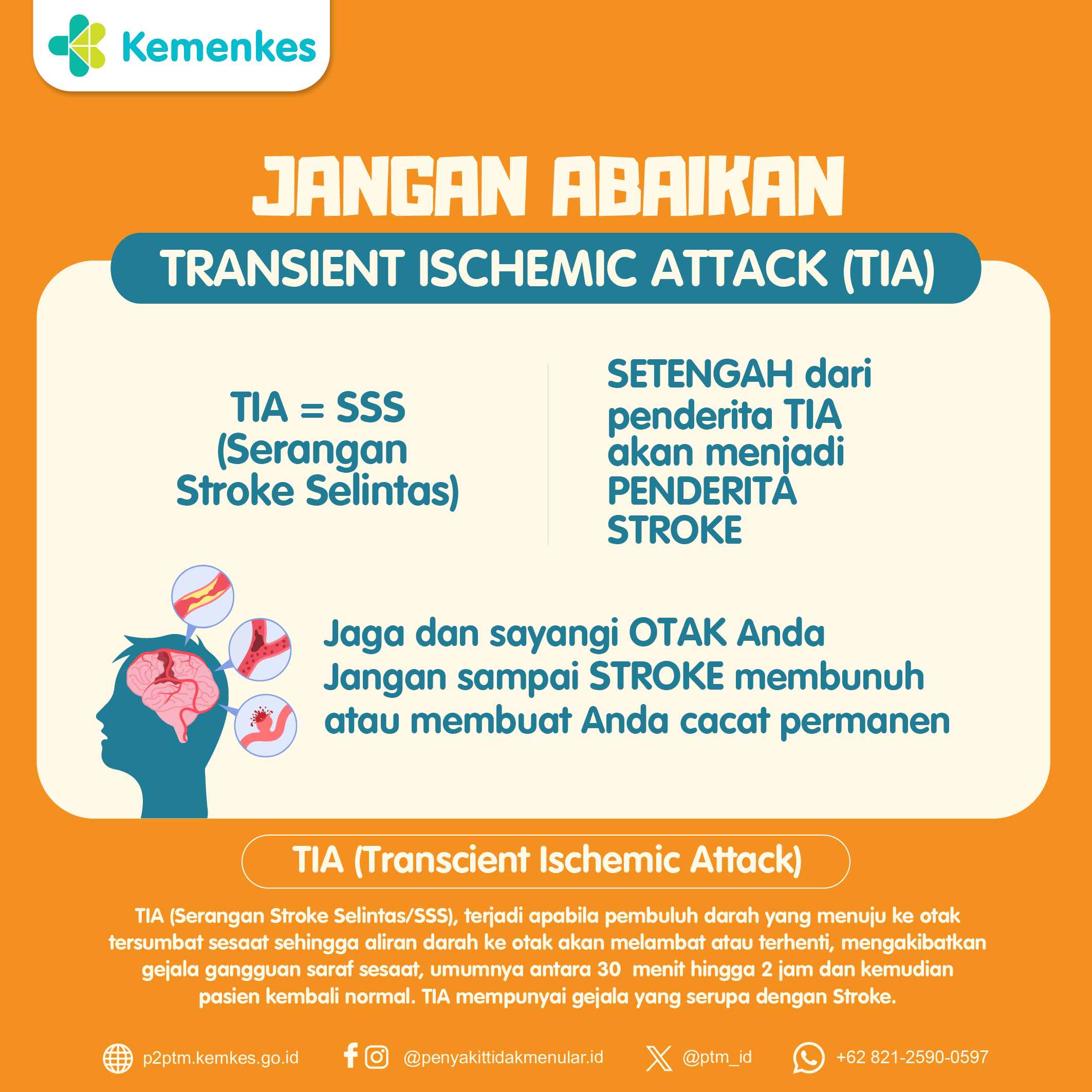 Jangan Abaikan Transient Ischemic Attack (TIA).