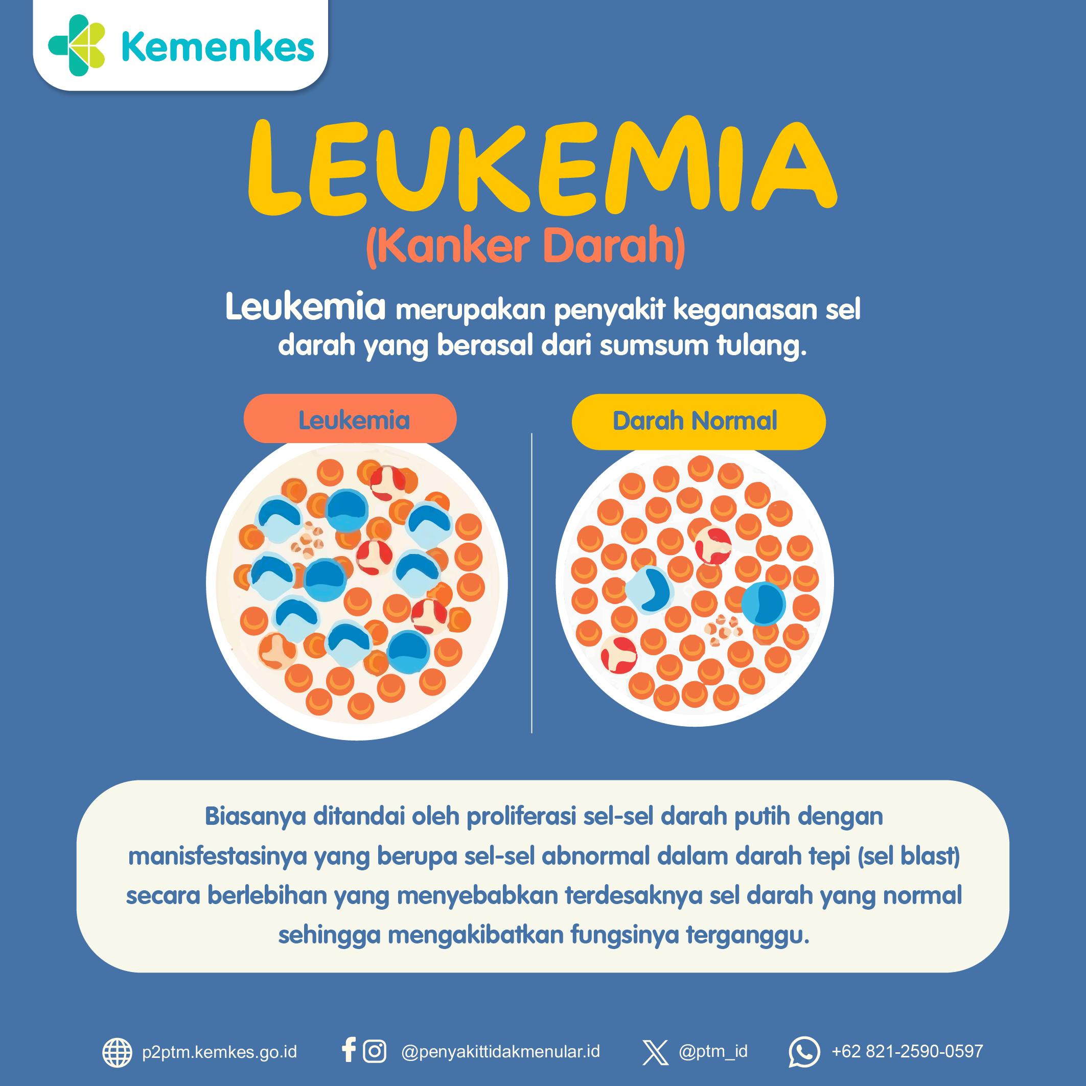 Mengenal Leukemia (Kanker Darah)