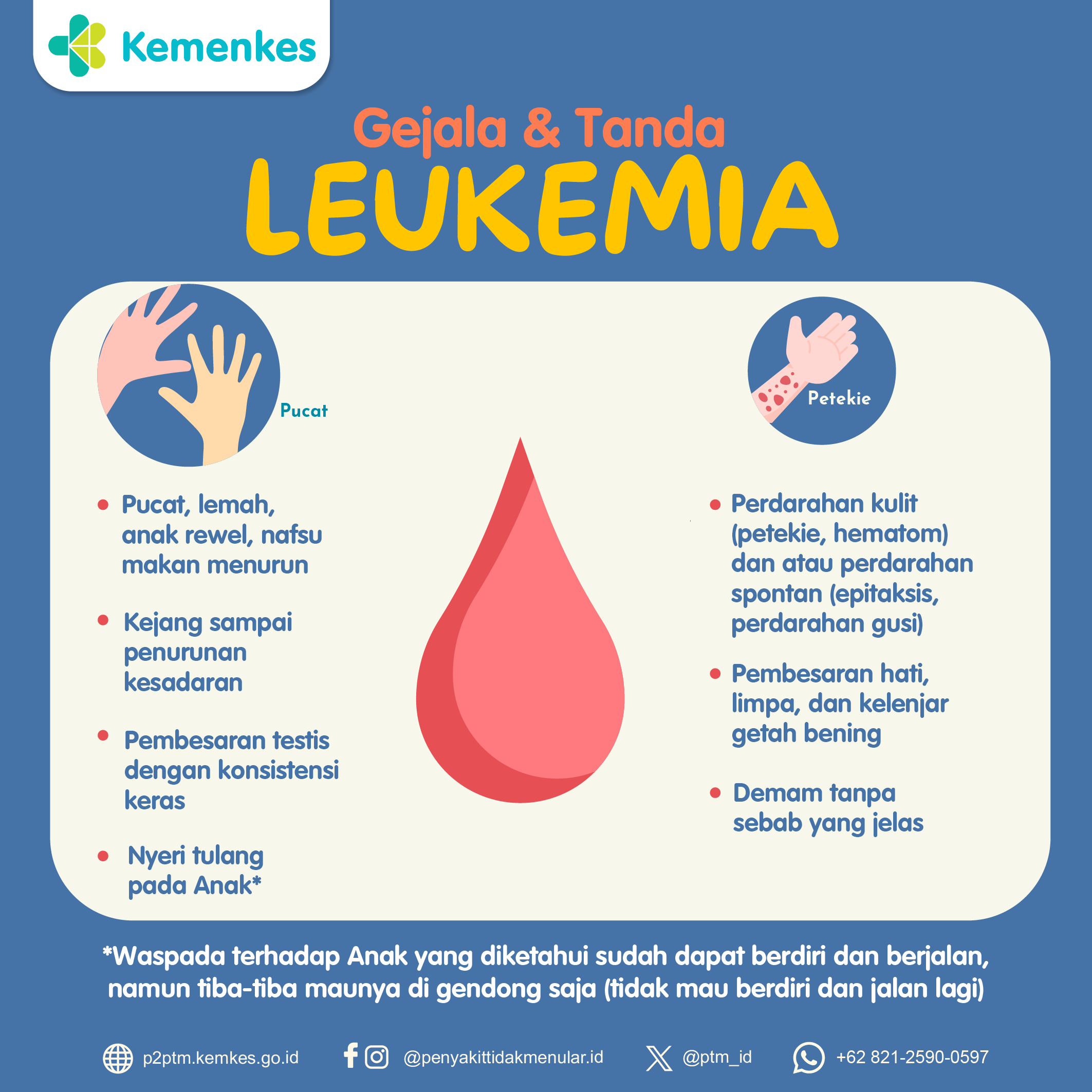 Yuk, Kenali Gejala dan Tanda Leukemia!