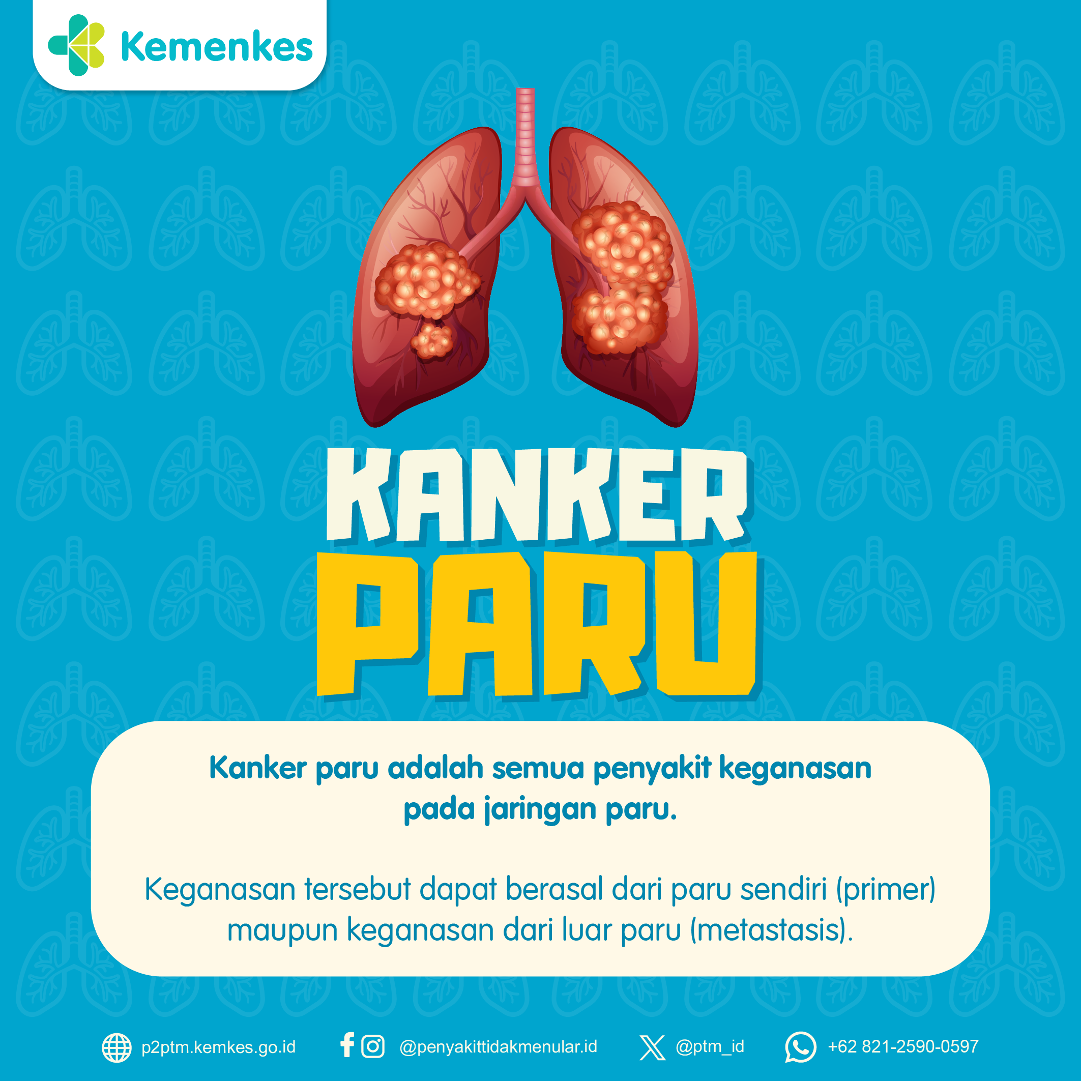 Mengenal Penyakit Kanker Paru