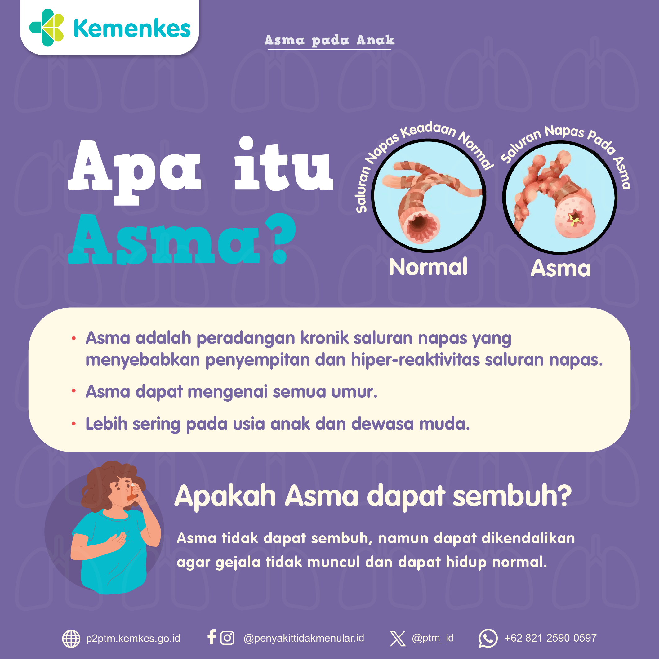 Apa yang Dimaksud dengan Asma?