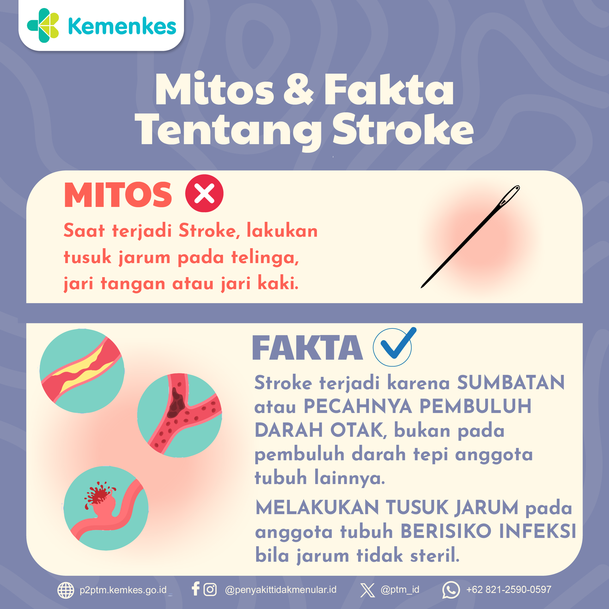 Mitos vs Fakta: Benarkah Tusuk Jarum Bisa Mengobati Stroke?