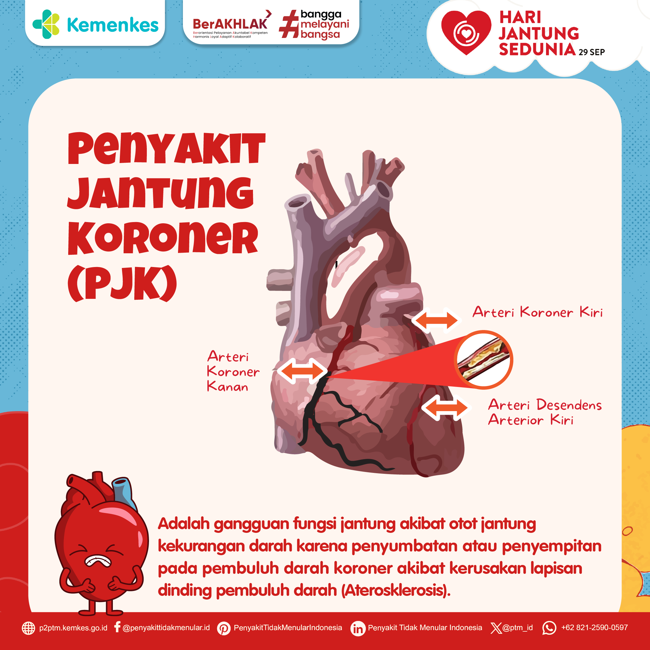 Kenali Penyakit Jantung Koroner (PJK), Penyebab, dan Pencegahannya