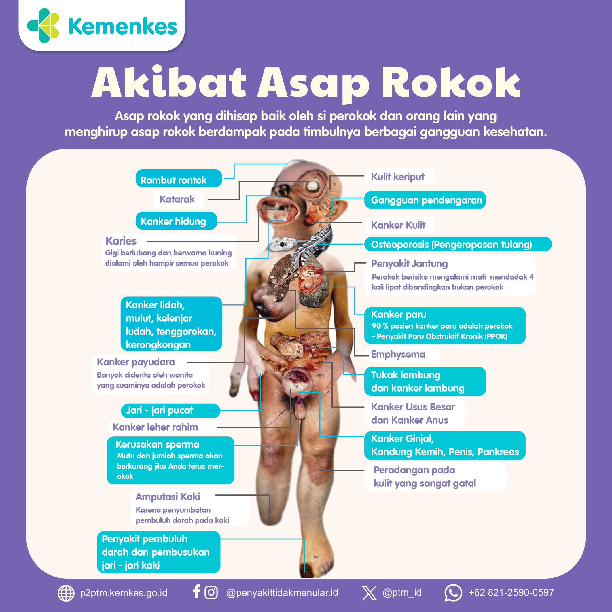 Bagaimana Akibat dari Asap Rokok pada Kesehatan Kita?