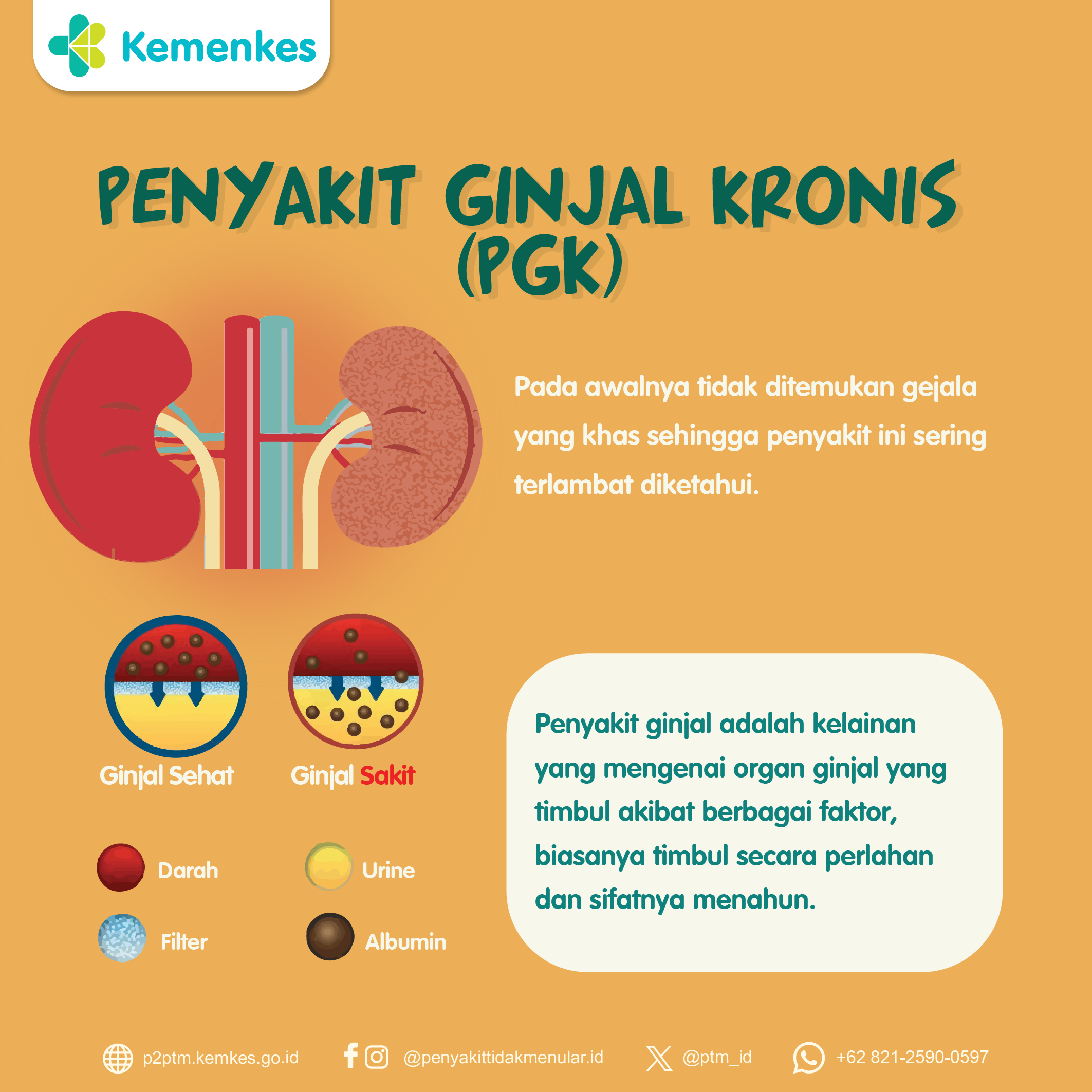 Mengenal Penyakit Ginjal Kronis (PGK). Yuk simak infografis berikut!