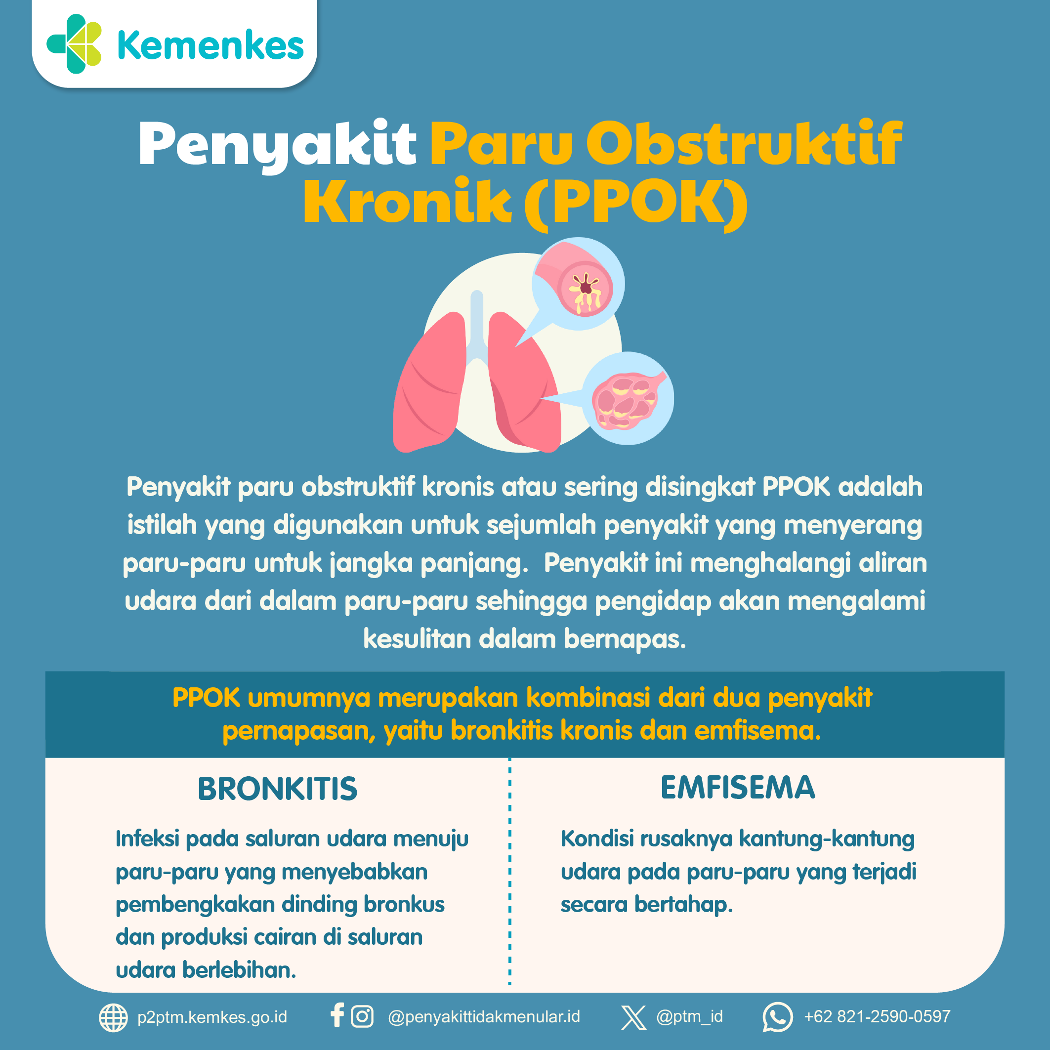 Apa itu Penyakit Paru Obstruktif Kronik (PPOK)?