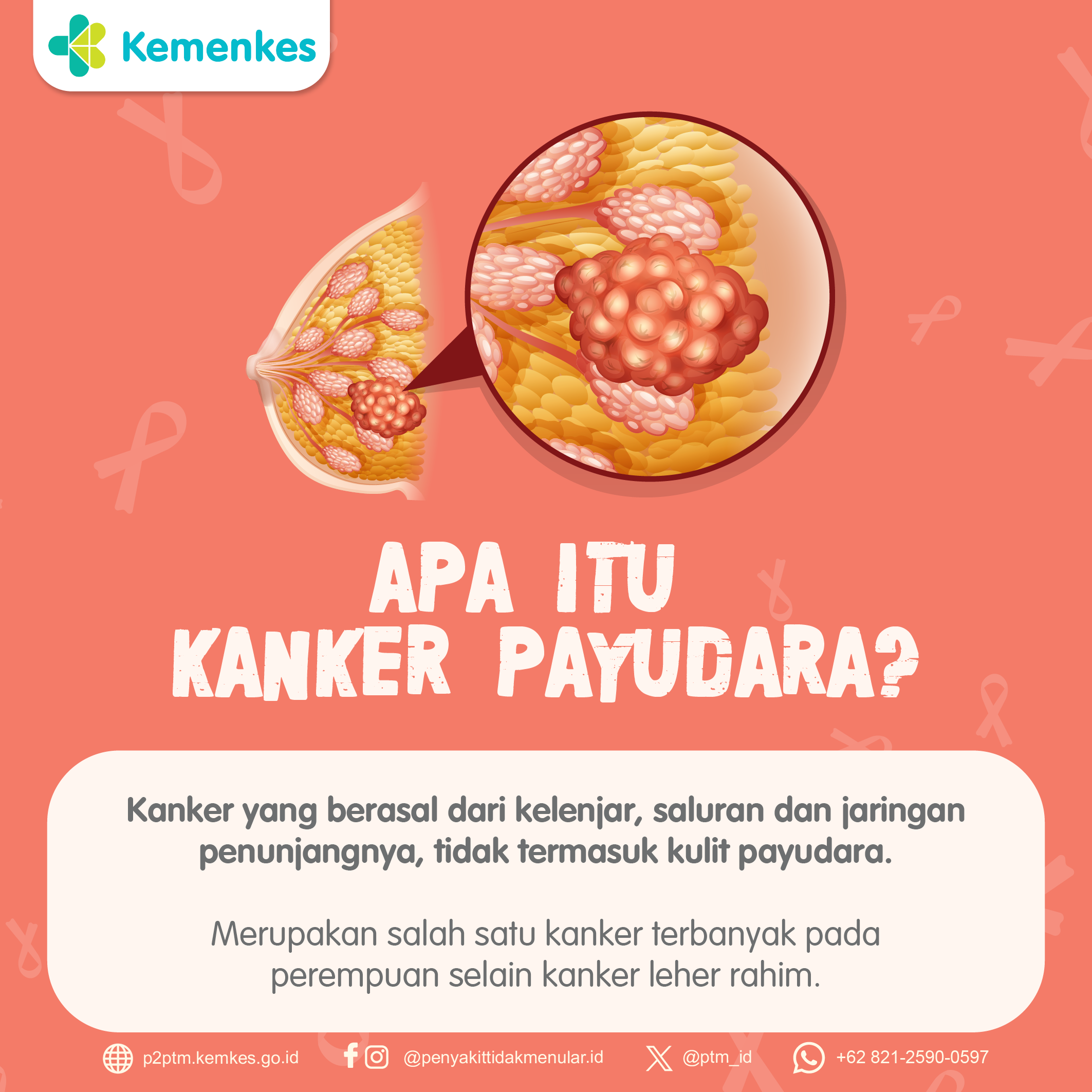 Apa Itu Kanker Payudara? Yuk simak Infografis berikut!