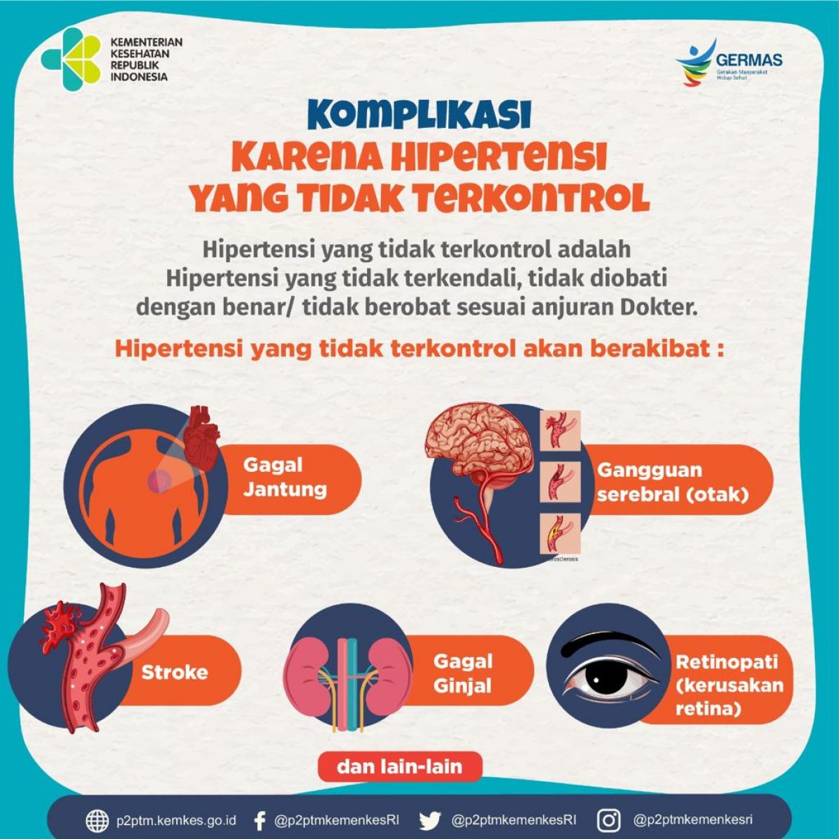 Inilah beberapa akibat Hipertensi yang tidak terkontrol/tidak berobat sesuai anjuran Dokter.