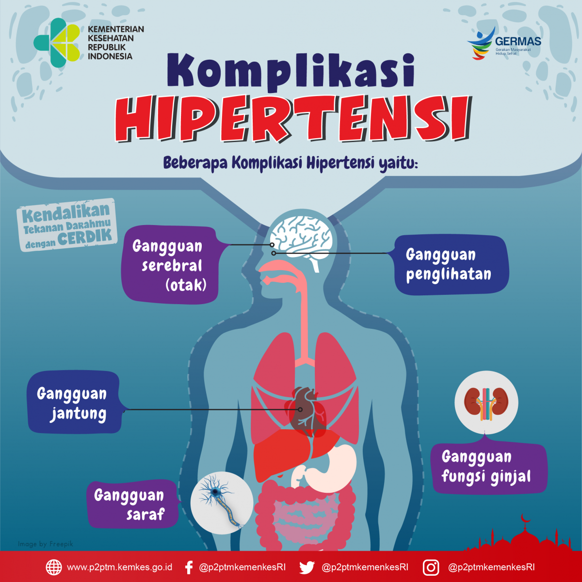 Beberapa komplikasi akibat Hipertensi