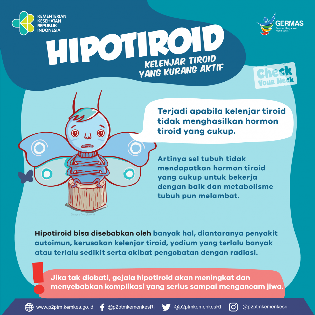 Apa itu Hipotiroid, si kelenjar tiroid yang kurang aktif?