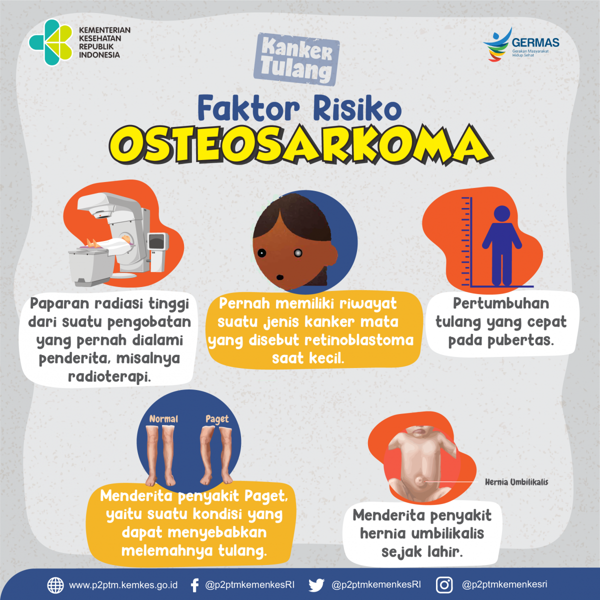 Faktor risiko yang menyebabkan Osteosarkoma