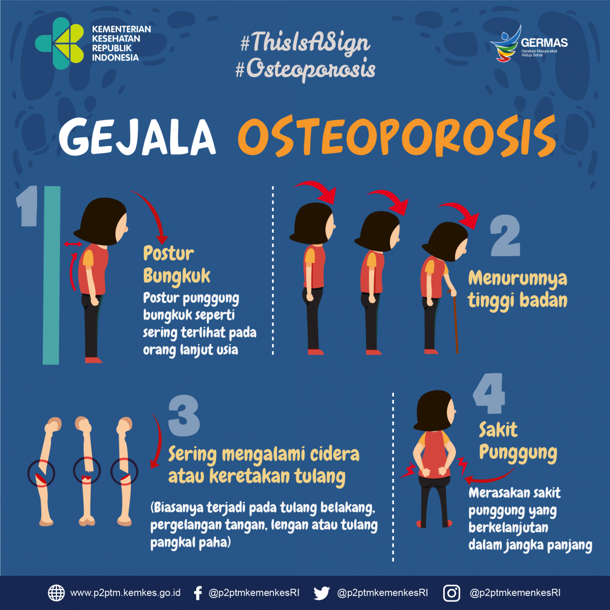 Apa saja gejala Osteoporosis?