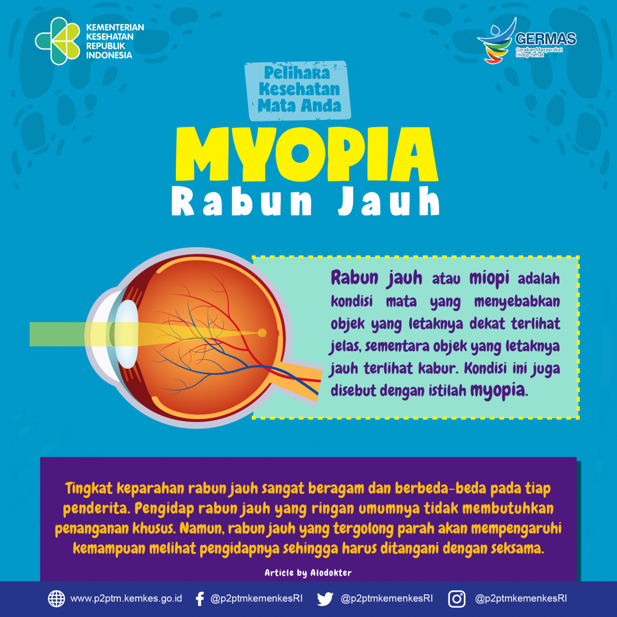 Apa itu Myopia (Rabun Jauh) ?