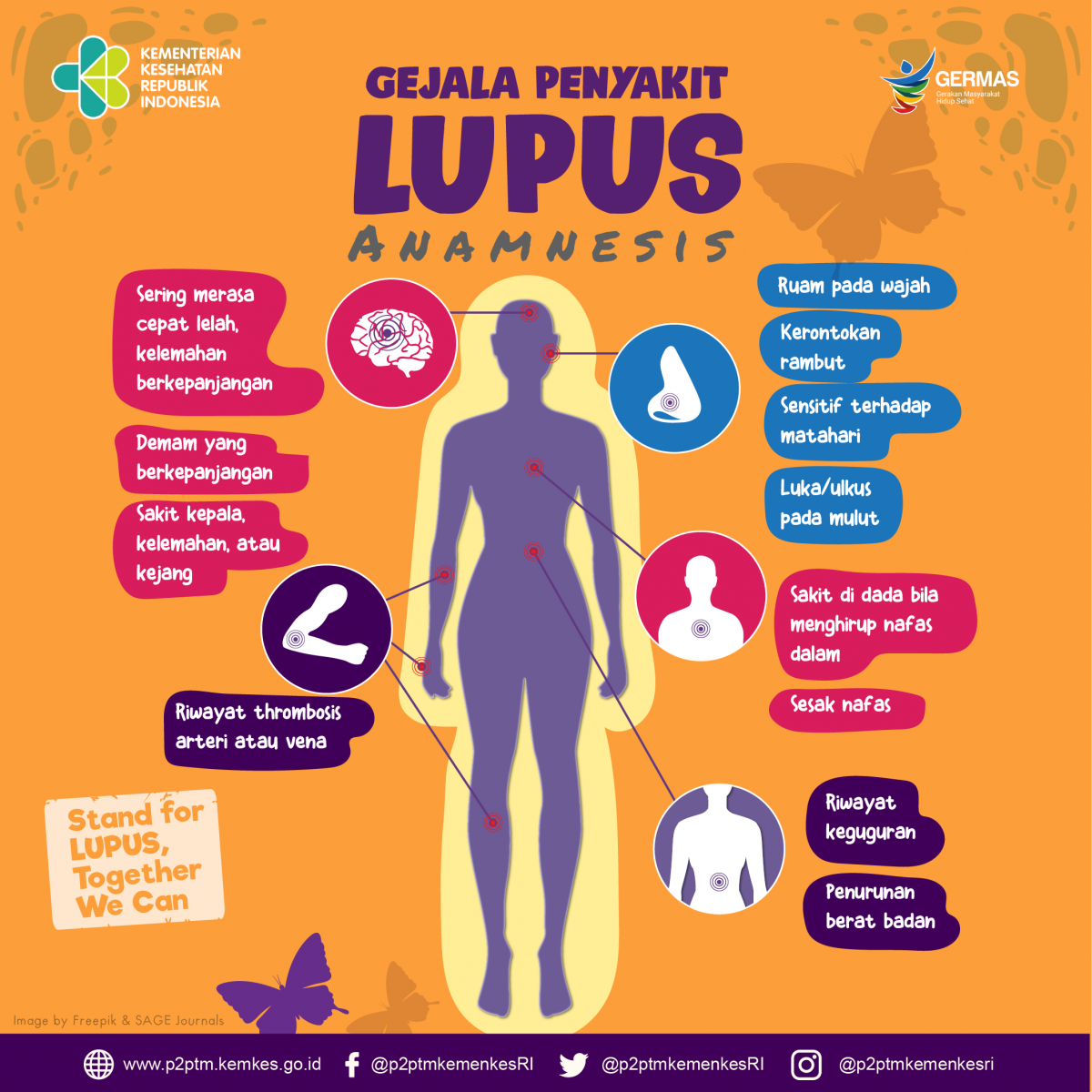 Kenali Gejala Penyakit Lupus