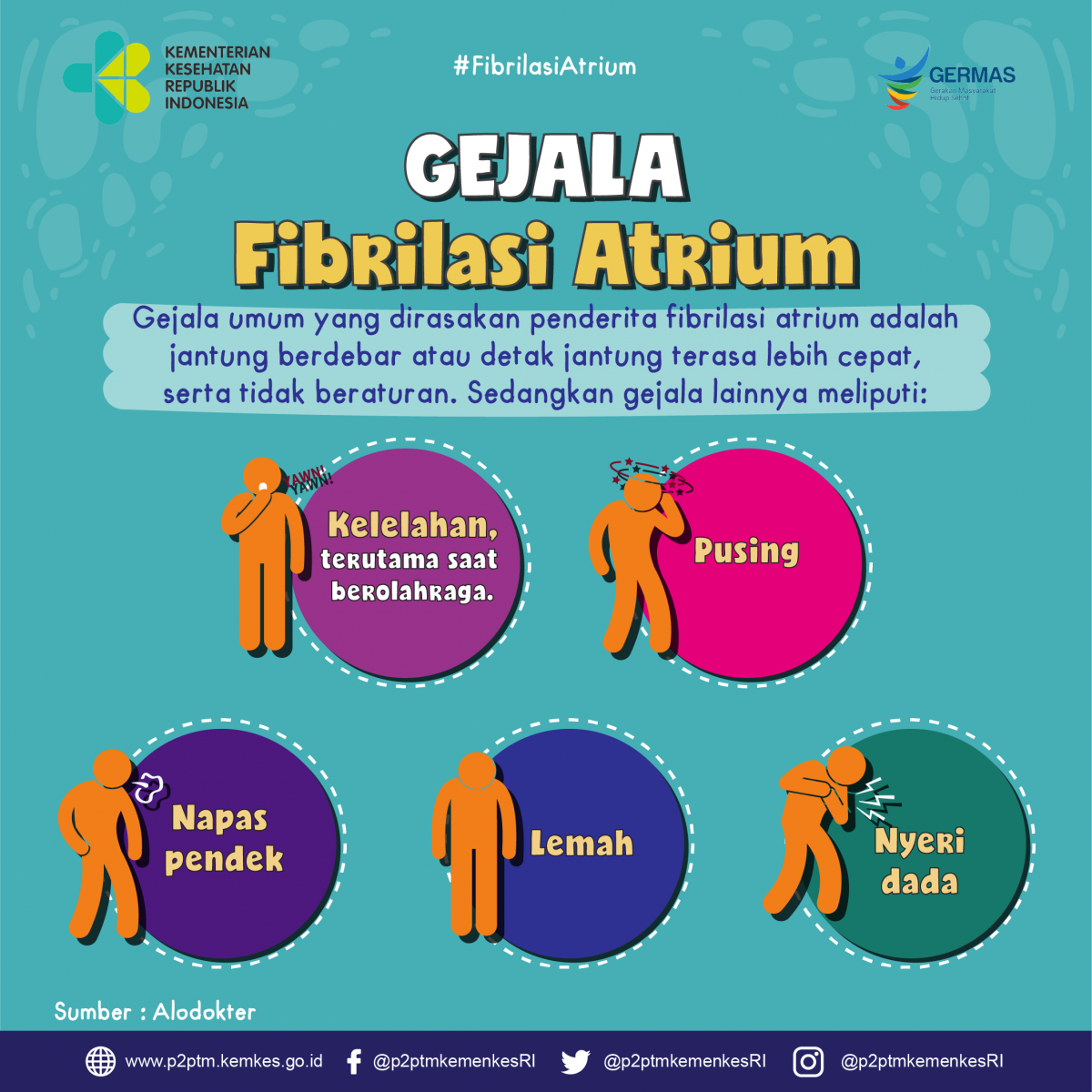 Apa saja gejala fibrilasi atrium?