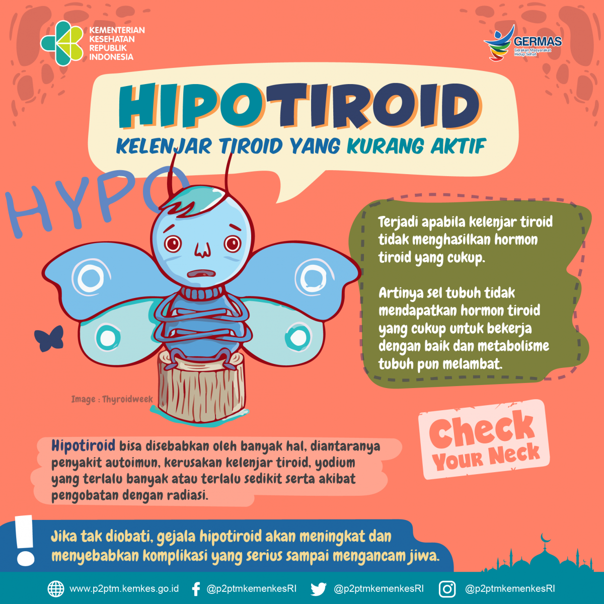 Hipotiroid, Si Kelenjar Tiroid yang Kurang Aktif