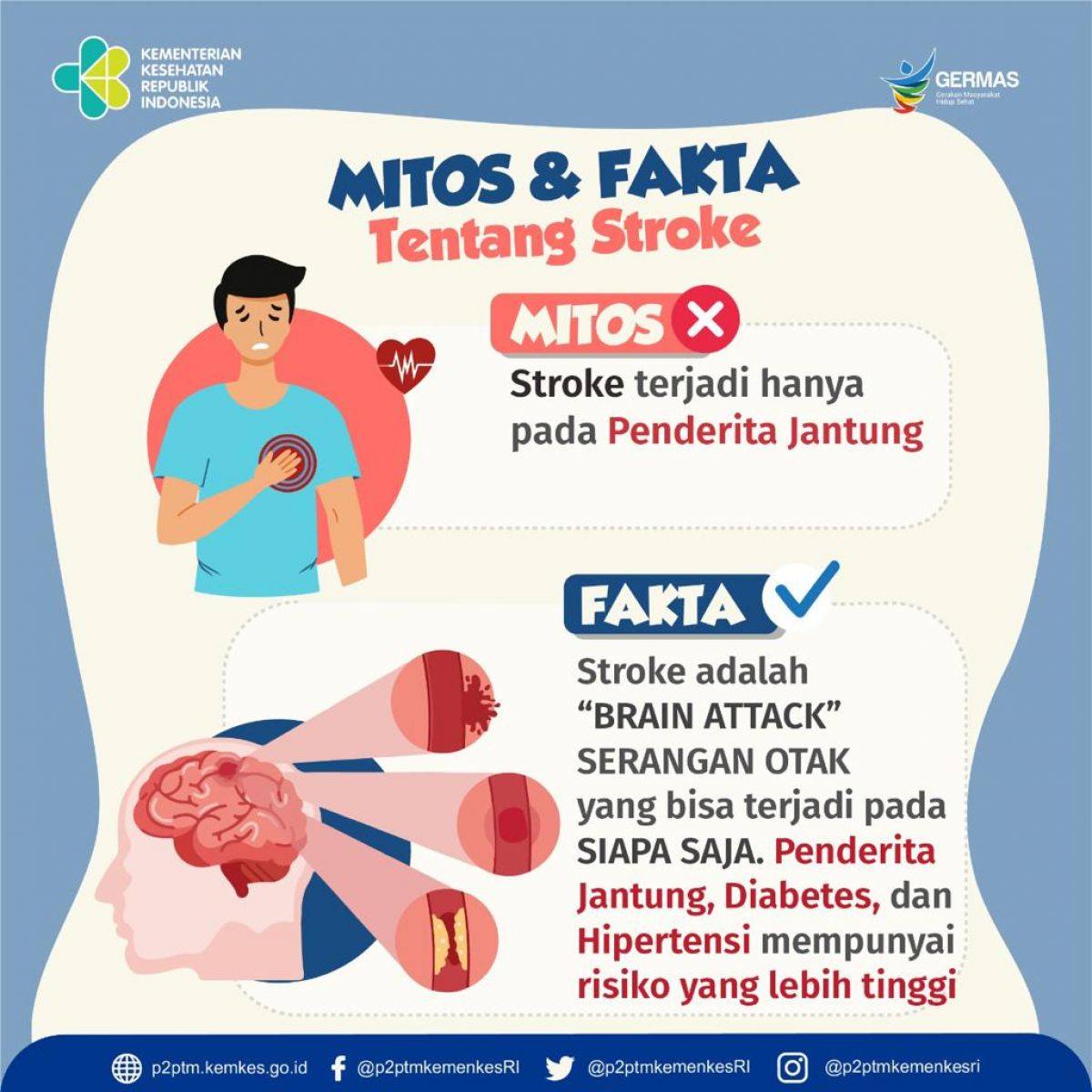 Waspada, Stroke dapat terjadi pada siapa saja.