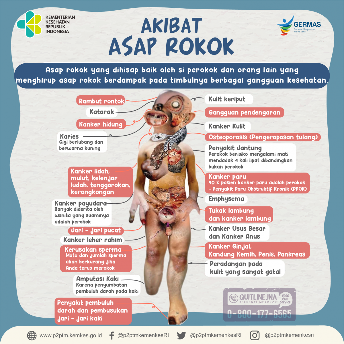 Sobat Sehat, yuk simak gambaran akibat dari asap rokok.