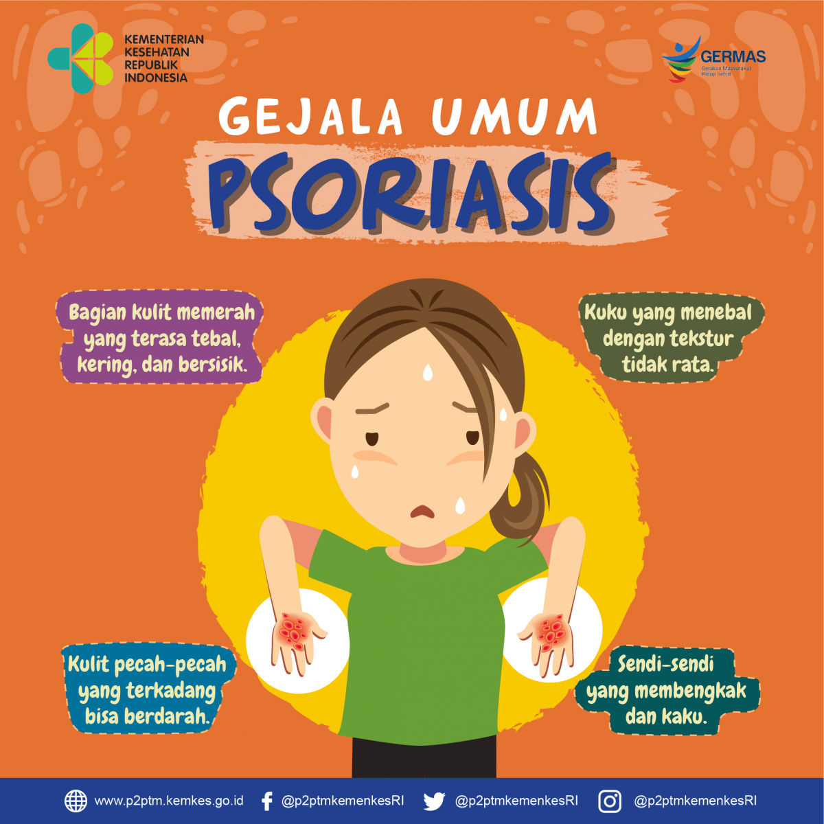 Apa saja gejala Psoriasis ?