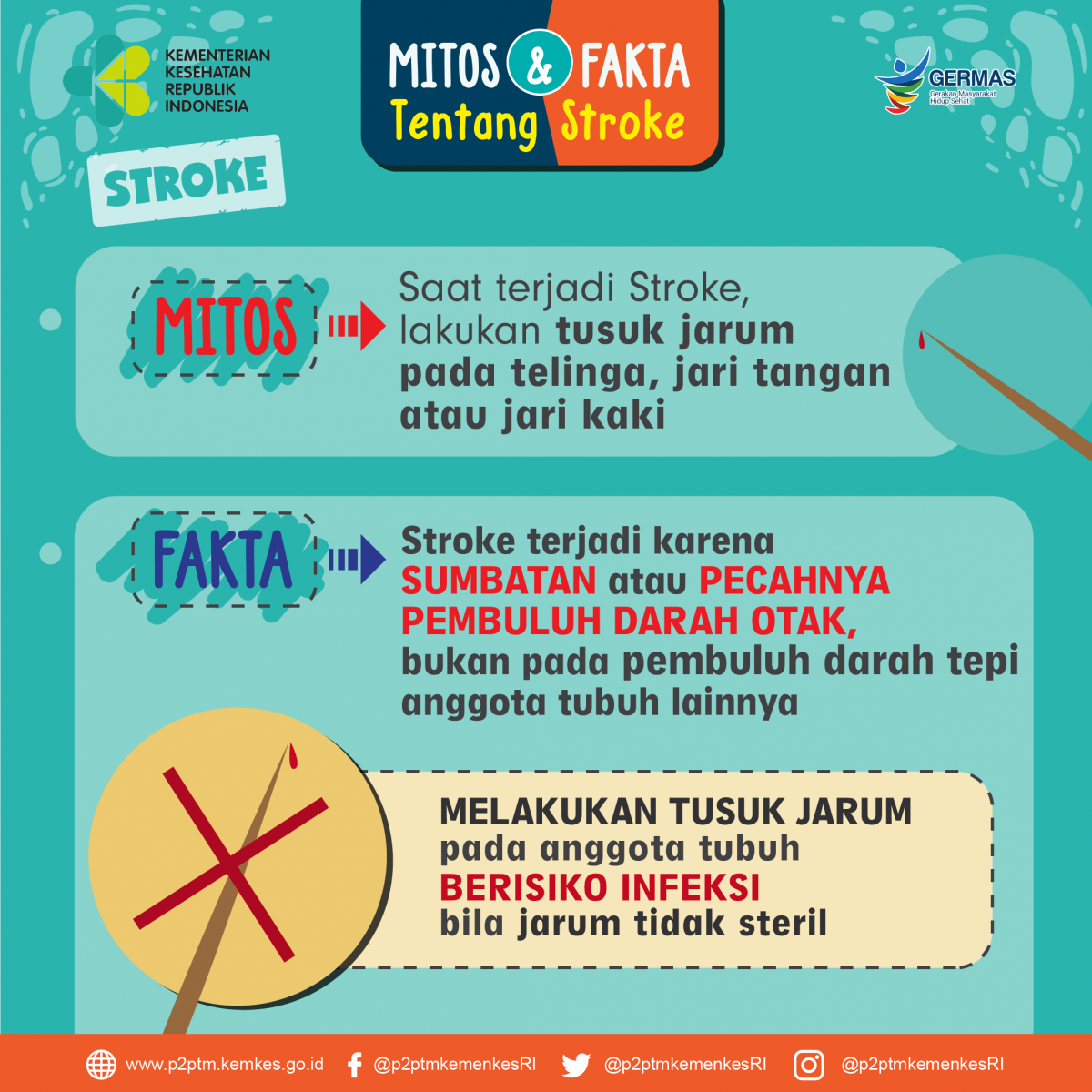 Benarkah mitos melakukan tusuk jarum saat terjadi Stroke?