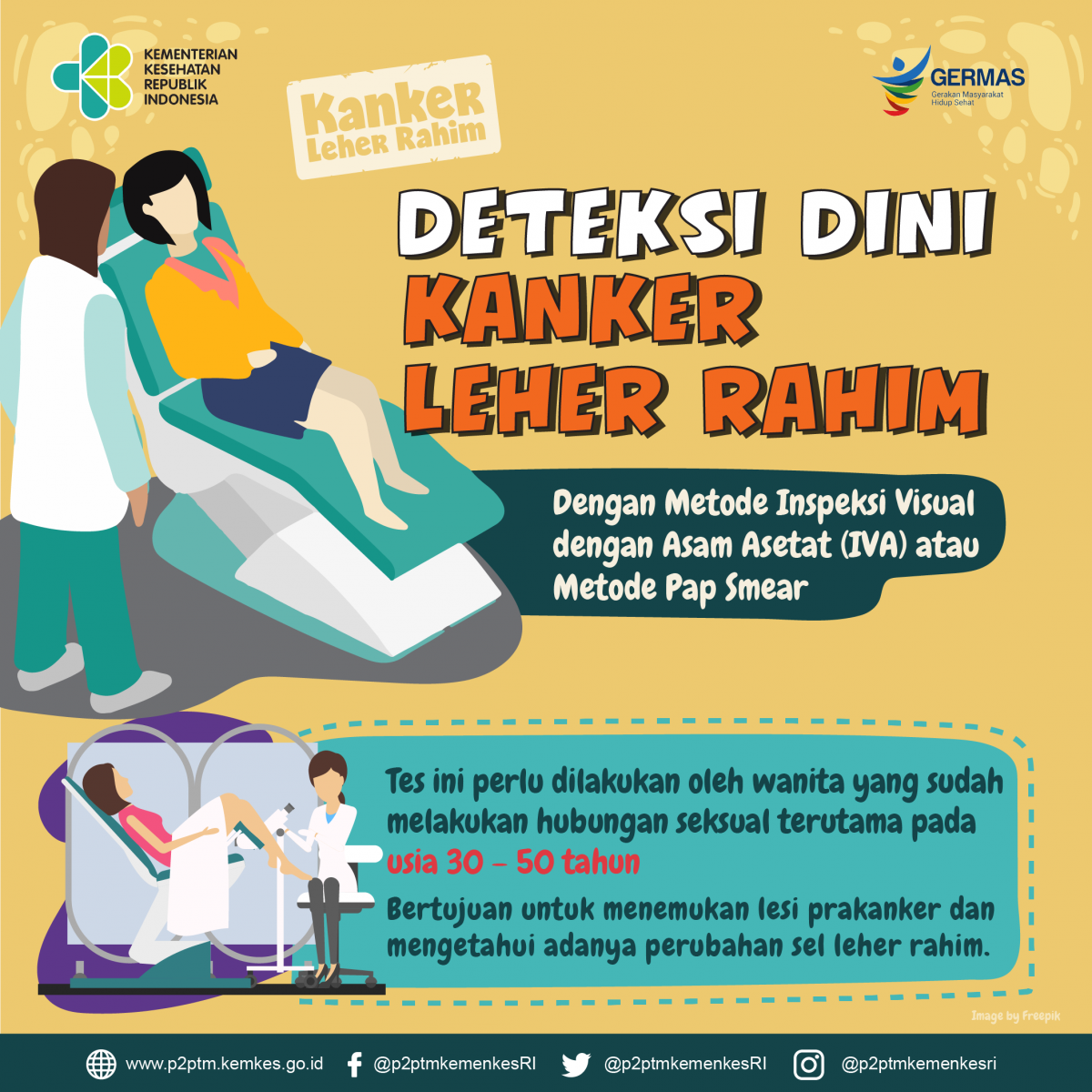 Kanker Leher Rahim dapat dideteksi sejak dini dengan metode IVA dan metode Pap Smear