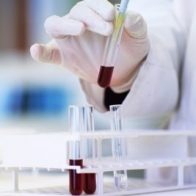 Protein untuk Hentikan Penyebaran Kanker Payudara Telah Ditemukan