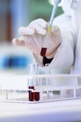 Protein untuk Hentikan Penyebaran Kanker Payudara Telah Ditemukan