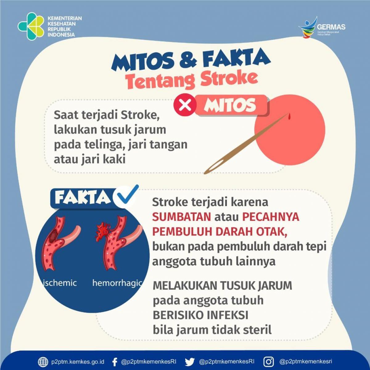 Hindari melakukan tusuk jarum pada saat STROKE.