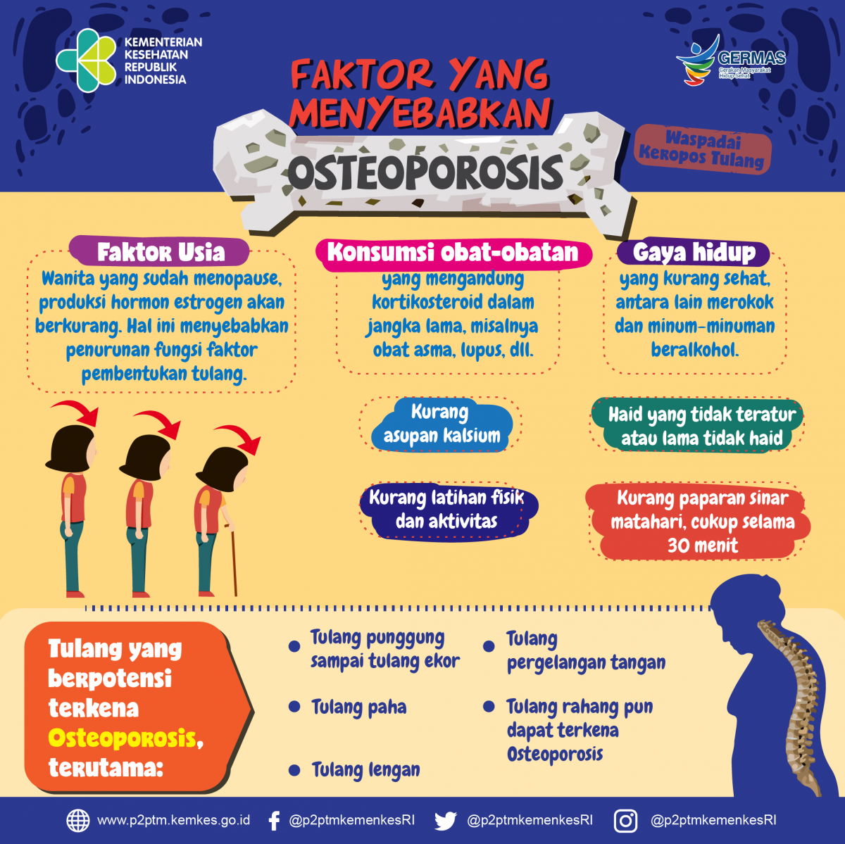 Apa saja faktor yang menyebabkan Osteoporosis?