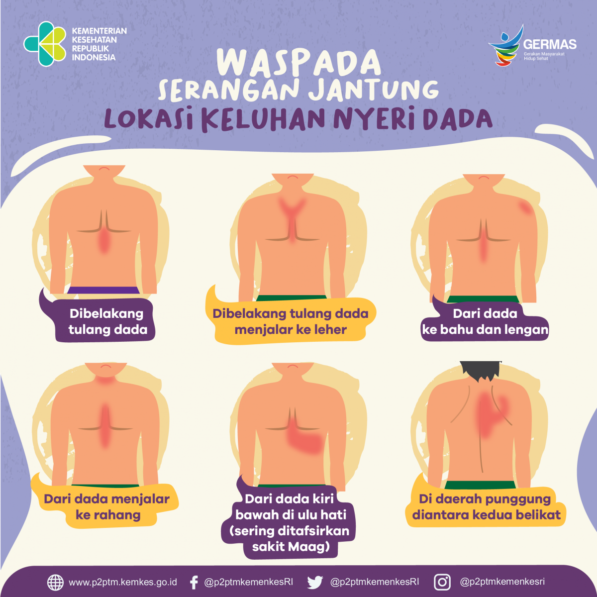 Waspada Serangan Jantung! Inilah lokasi Keluhan nyeri dada.