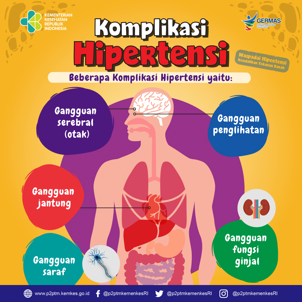 Yuk, simak beberapa komplikasi Hipertensi